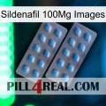 Sildenafil 100Mg Images viagra4